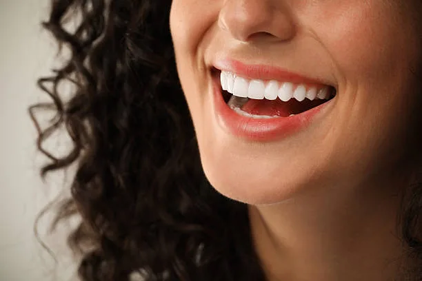 Paciente sonriendo tras un tratamiento de carillas dentales